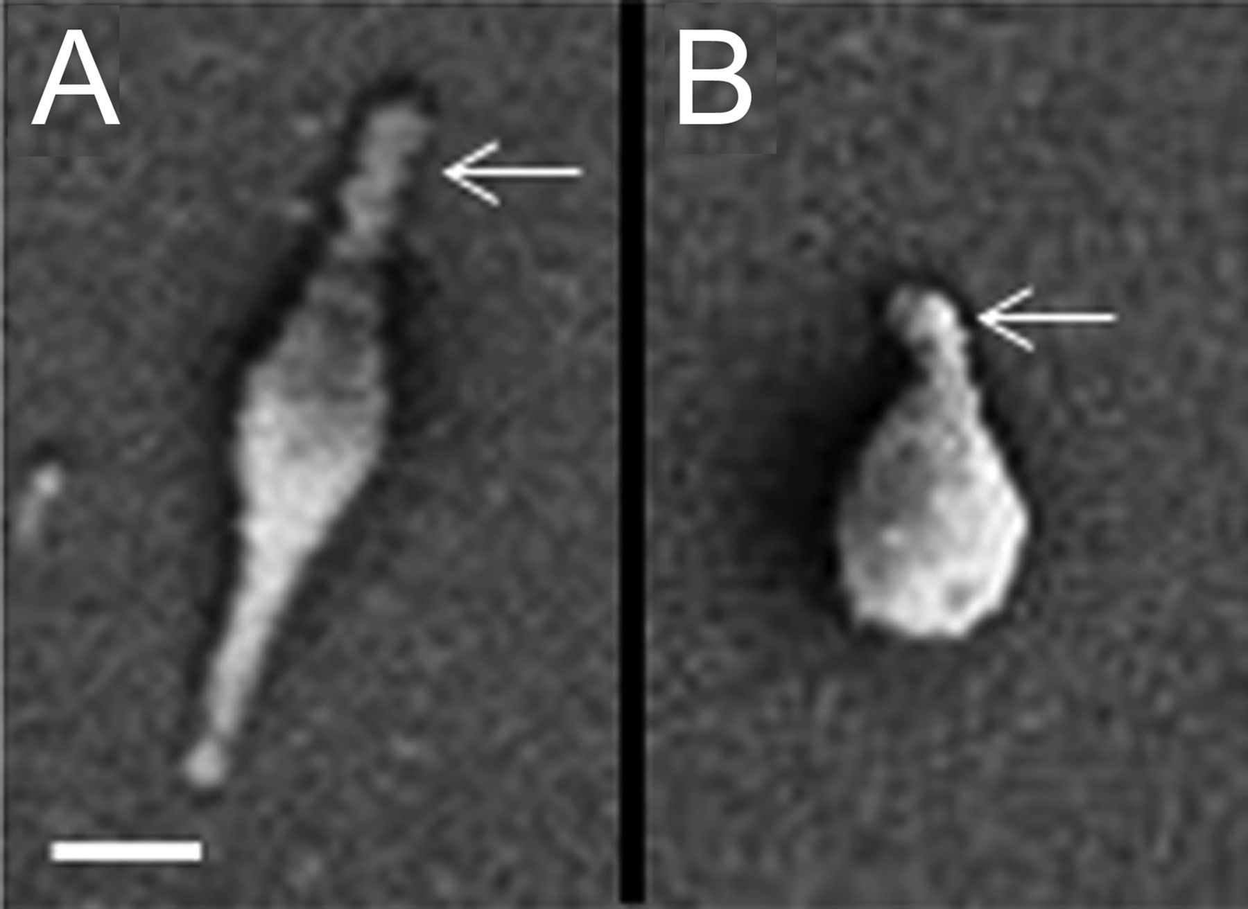 mycoplasma pneumoniae